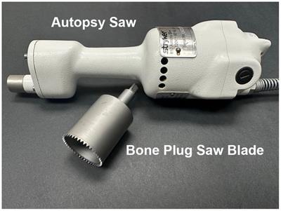 Mortui vivos docent: a modern revival of temporal bone plug harvests